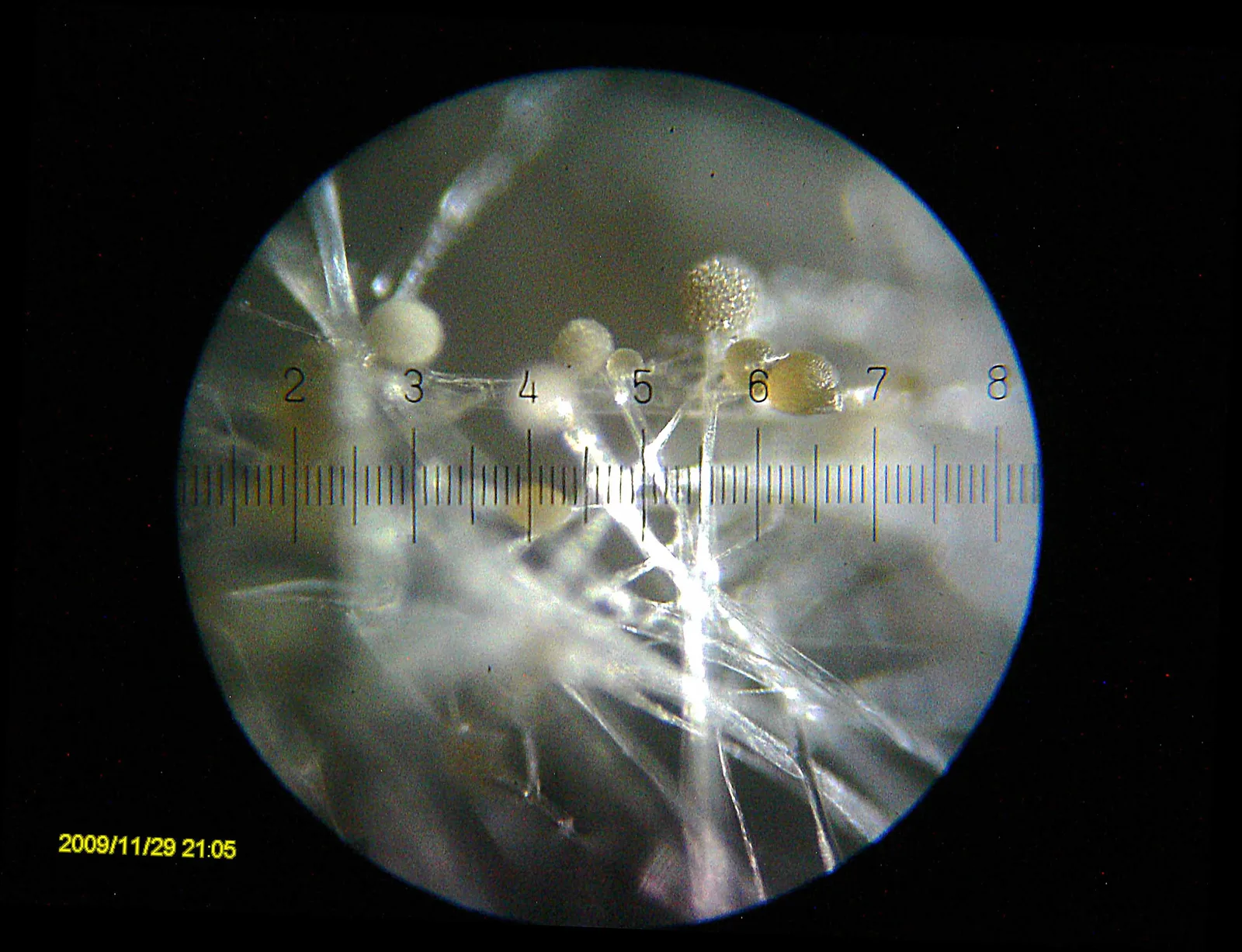 Vue microscopique des moisissures et champignons présents sur un filtre habitacle de voiture contaminé — spores Aspergillus